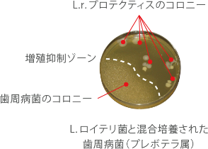 L.ロイテリ菌と混合培養された歯周病菌(プレボテラ属)